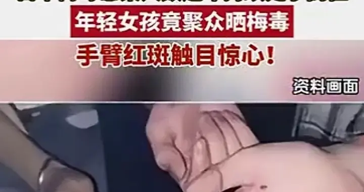 日本年轻女孩竟然聚众晒梅毒！手臂红斑触目惊心！