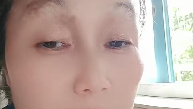 刘柏勋：77年蛇妈妈的半生：两个特殊孩子