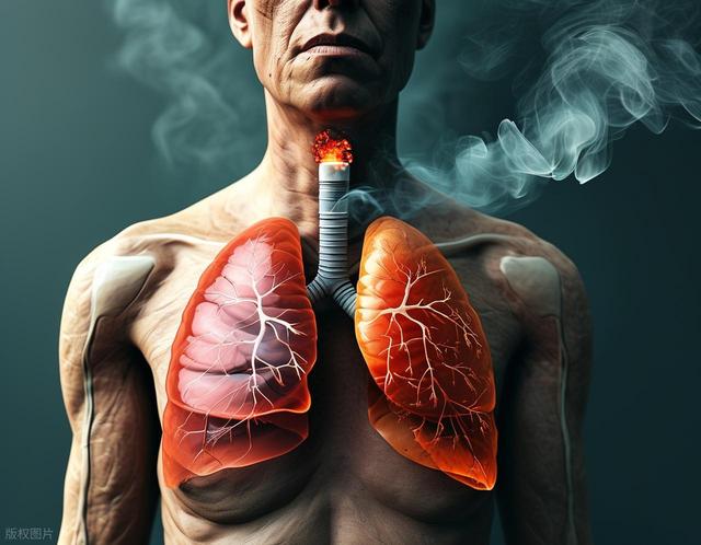 肺癌需要补充蛋白质吗