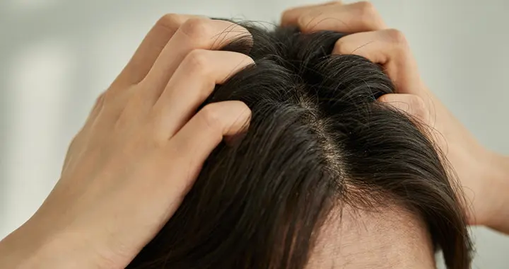 上海一女子用“硫磺皂”洗头，坚持半年后，出现了这4个变化