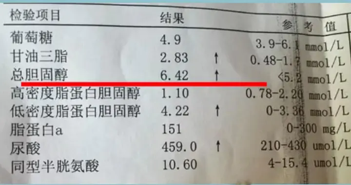 新血脂标准已更新，低密度脂蛋白最佳值不再是3.4，早知早受益