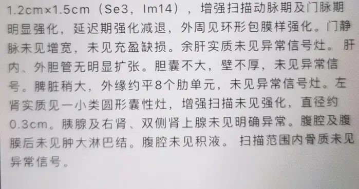 53岁小肝癌，pT1a，MRD阴性，术后半年复发——病理报告解读