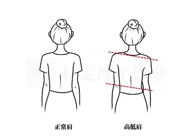 医林正骨丨常背单肩包、歪着身子坐的，赶快收好这2个锻炼动作