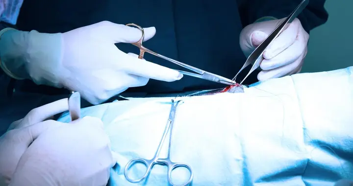 多名医生提醒：只要做过肿瘤切除手术，术后患者必须警惕这5点