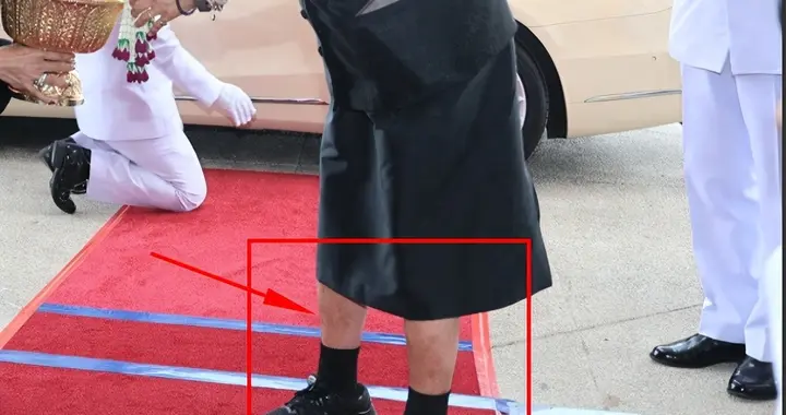 诗琳通公主为侄女发博士证，头发已全白，腿部臃肿长褐斑身体堪忧