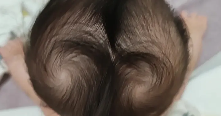 孩子头顶“2个旋”，你知道代表什么吗？很多父母都不知道