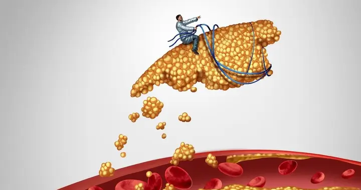 十人降脂九人患病？医生告诫：降血脂不控制好这个度，适得其反！