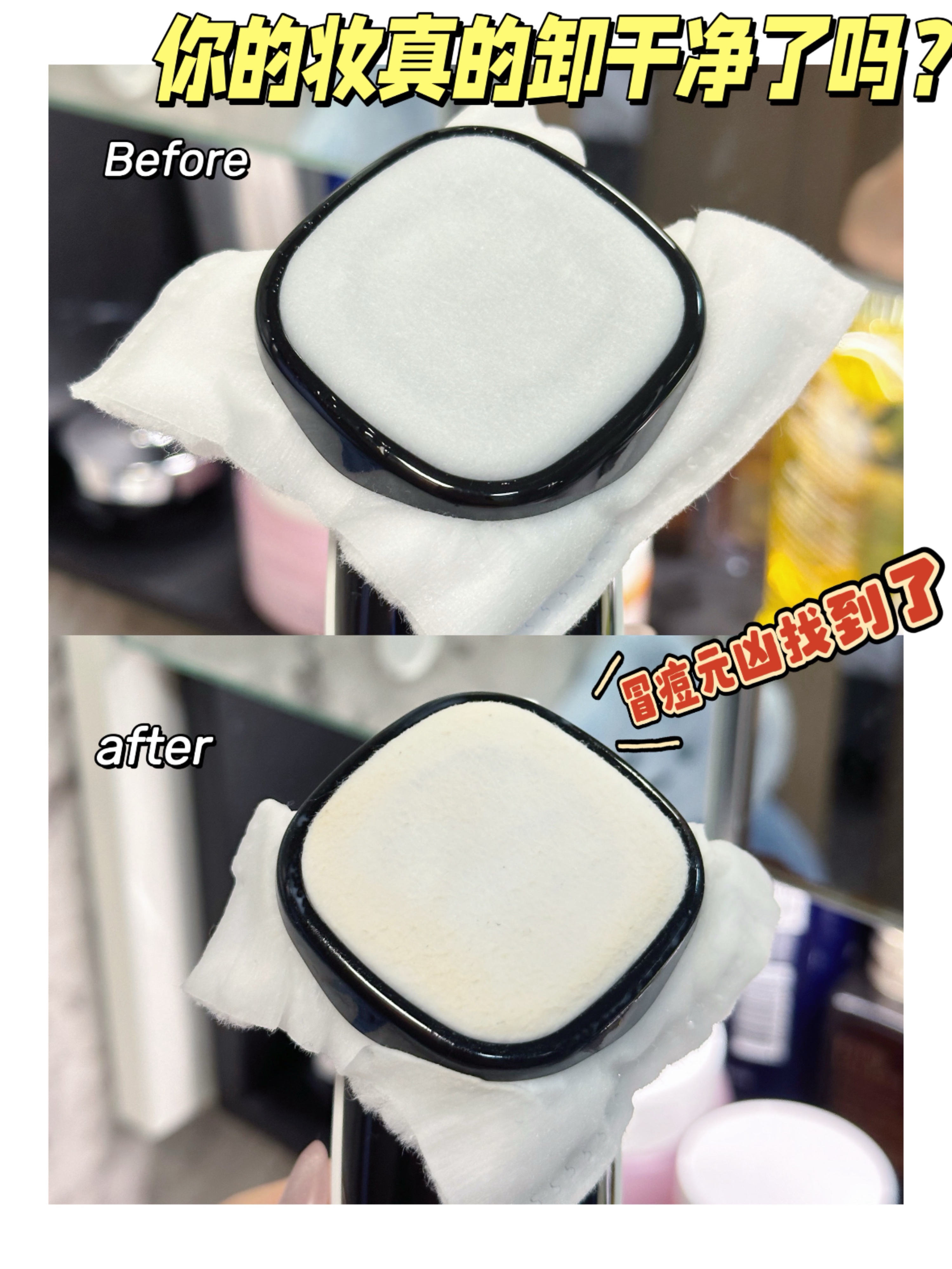 冒痘痘的原凶找到了！！！