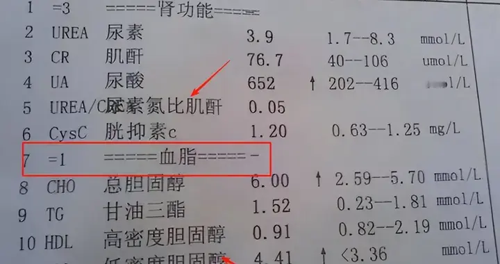 体检报告中有个指标与脑梗、心梗都有密切关系，却经常被忽略