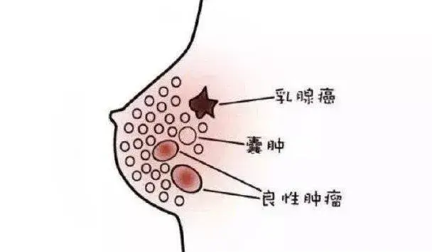 老祖宗留下的散结智慧：一棵草竟成女性护胸秘密武器？