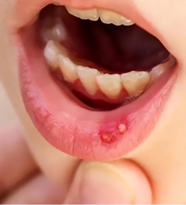 死不了但很折磨人的小病，而且有钱还治不了，网友：我真的崩溃了