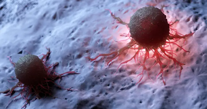 协和医生提醒：癌症恢复有 3 个黄金期，熬过第 3 个就算 “治愈”！