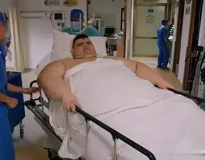 世界上最胖的十个人，超出你的想象