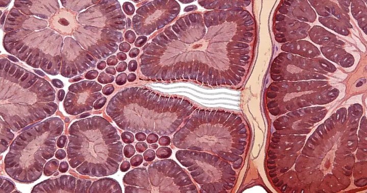 肝硬化往往不是一夜形成的，若有这些异常，说明肝脏已经很吃力了