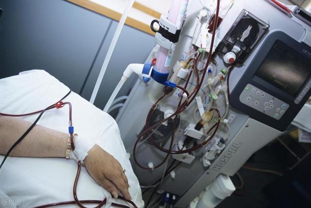 34岁女子因吃一物要终生透析，医生再三叮嘱：这几物最好要少吃