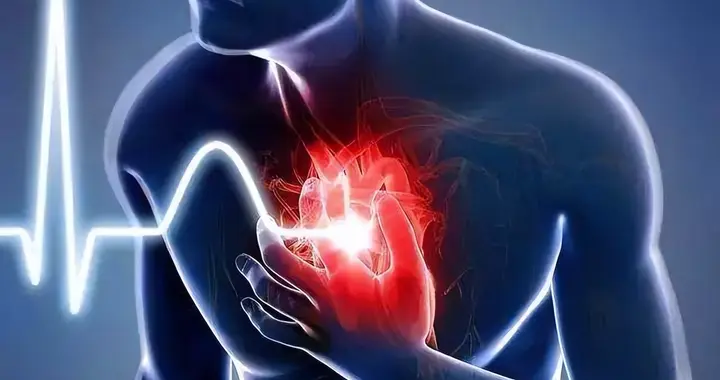 心脑血管疾病正在年轻化，30岁左右人群越来越多，5个习惯易患病