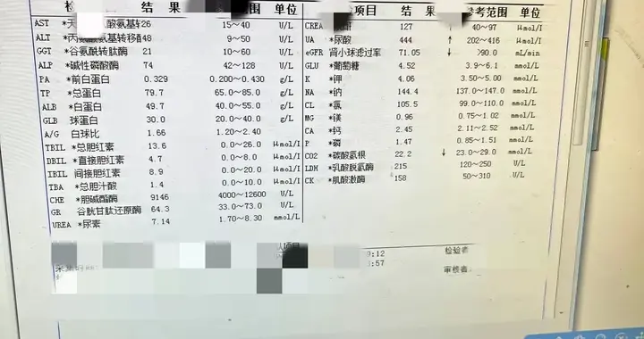 二十年前的HIS，被嫌弃的老古董，却偷偷用上了DeepSeek？