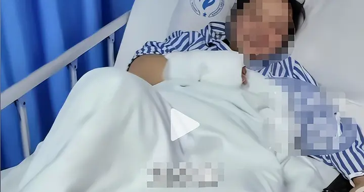 侥幸习惯暗藏杀机！女子全身3%深2-3级烧伤进ICU，多数人每天在做