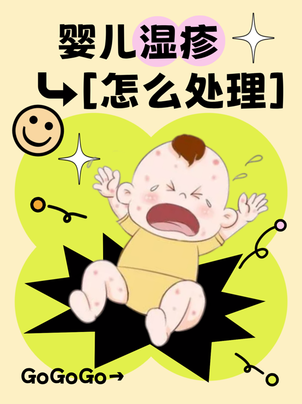 婴儿湿疹怎么处理