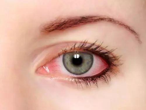 五味中药，堪称“眼科外症，千古一方”