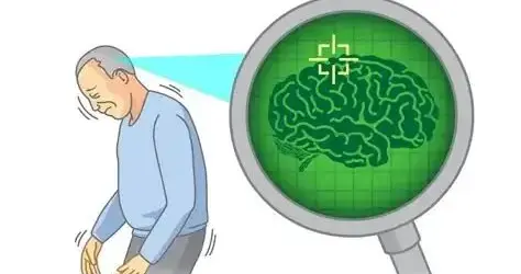 细胞治疗帕金森后，他的力量回来了——一位大学英语老师的5年