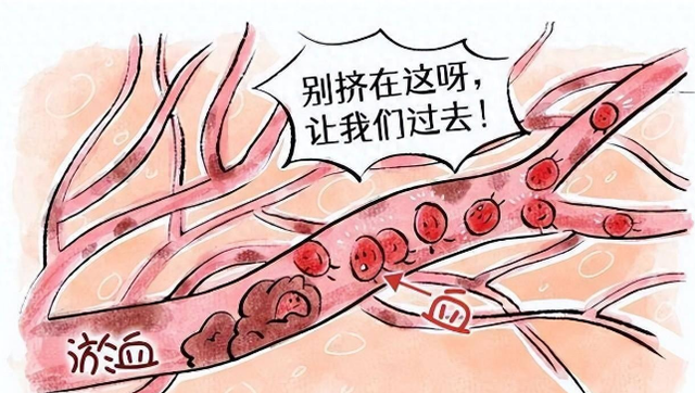 化瘀不在活血，而在补阳，血府逐瘀加一味，阳气充盈，血脉畅行!