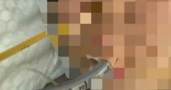 痛心！10岁男童吃猪蹄卡喉去世，母亲崩溃：吃一口就要了他的命！