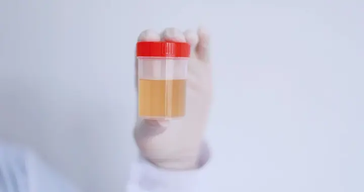 尿毒症来临前，4个肾功能异常可能会接踵而至，务必要小心