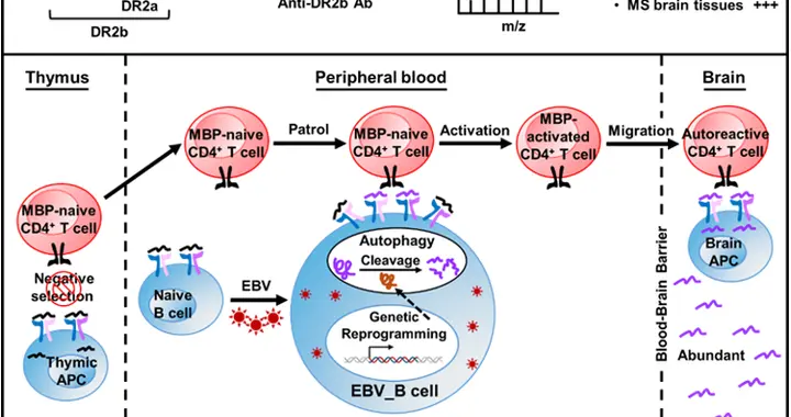中国科大破解多发性硬化症致病密码 | 科技前线