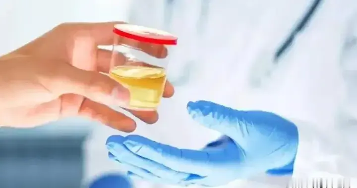 慢性肾脏病筛查要做哪些项目？一文讲清楚