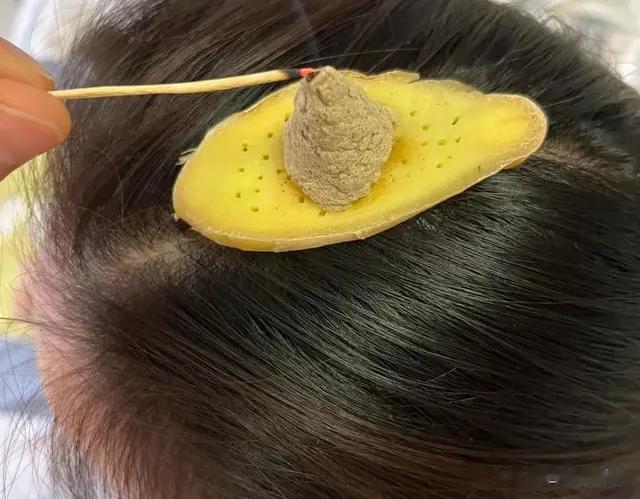 这个穴位一激活，失眠、脱发、记性差全改善！