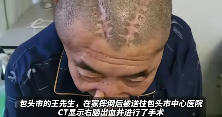 医生开错脑门，病人瘫了，医院转头却要160万！