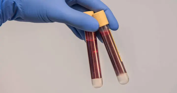 大寒过后，医生建议高血脂患者：宁可天天看电视，也别忽视这5点