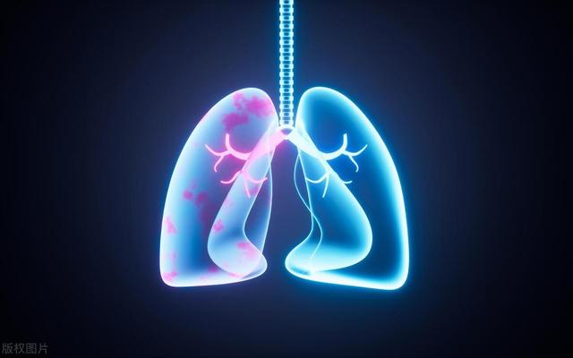 三种日常饮食，正在损害肺部健康！医生提醒这样吃保肺更健康