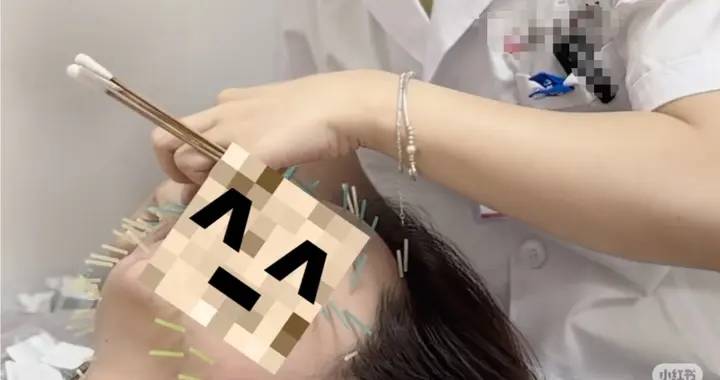 中医美容火到海外！9年深耕4家店，这家机构闯入纳斯达克？