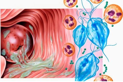 注意: 剪掉这个地方的毛发, 女人患上妇科病的风险将会翻倍!#UC订阅号#