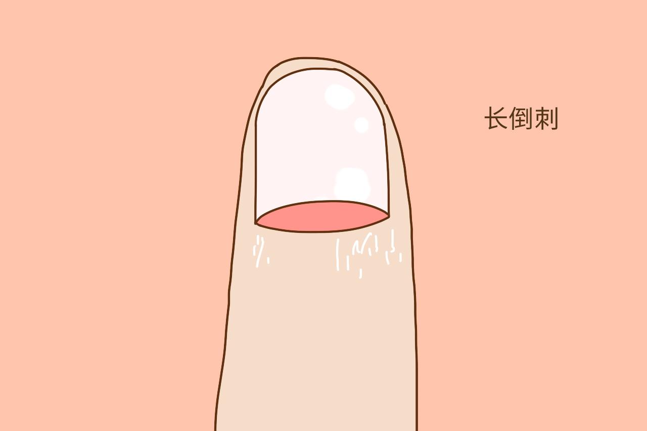 2.长倒刺