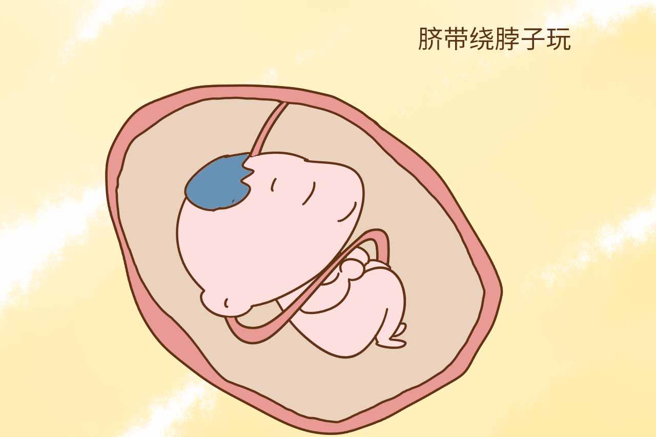 可是还有一些胎宝宝愣是不着急.