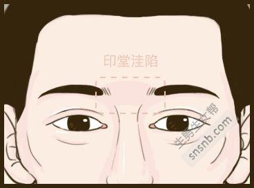 生男生女的 5 大面相特征, 您看准吗?