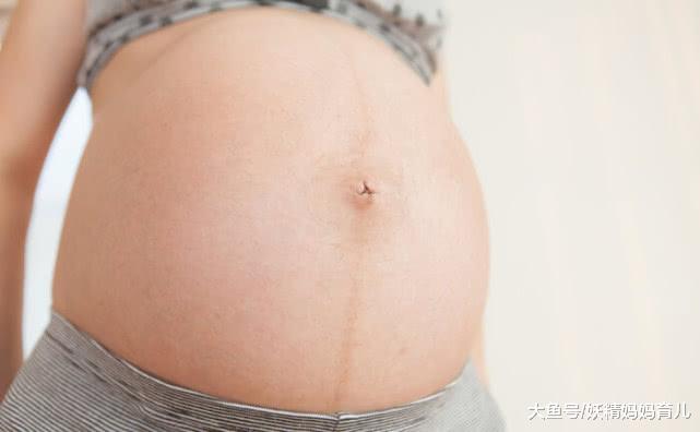 如何防止孕肚上的孕中线? 孕期产后做好这5点很重要