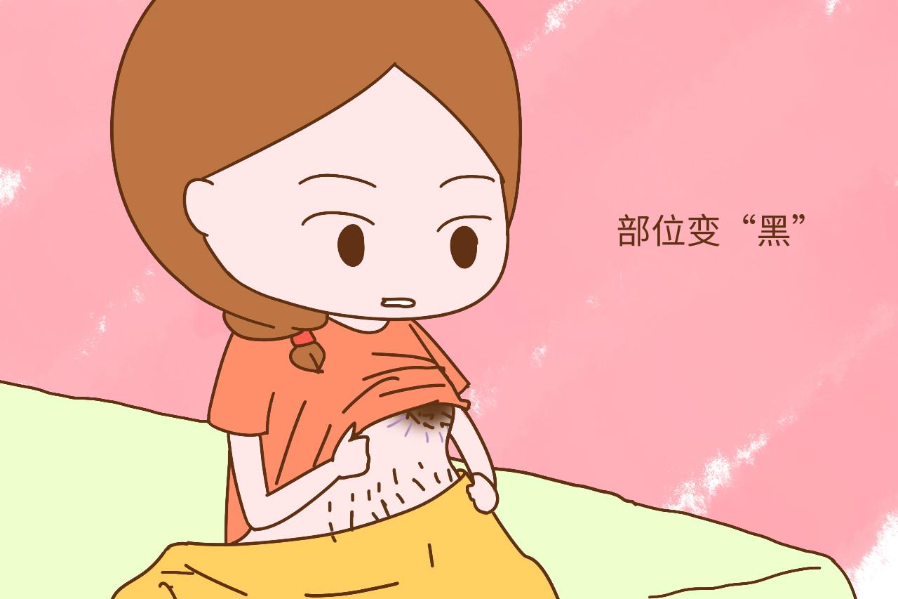 怀孕期间, 多数孕妈逃不掉这些身体变化, 尤其是第二种