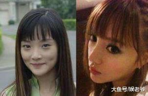 娱乐圈的这些人都整过容, 却打死不承认