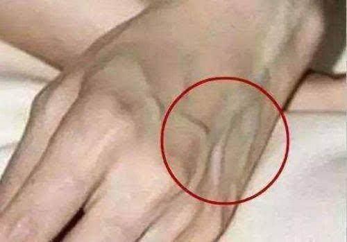 这五种食物是肝脏“吸毒王”, 平时多吃点, 大小肝病都赶跑!