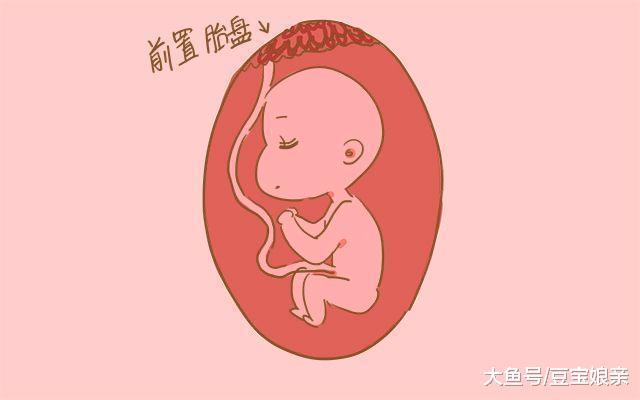 这4类准妈妈, 孕期还是多歇歇吧, 真的不适合多运动