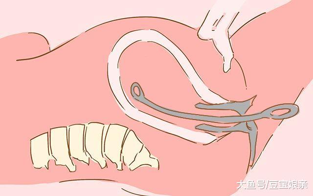 女性一生可以接受几次流产? 超过这个次数, 怀孕就难了