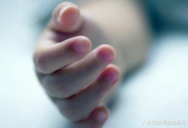 宝宝得了汗疱疹怎么办? 妈妈护理做好这几点