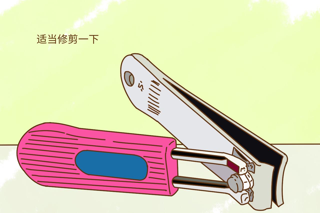 宝宝小手长倒刺, 可能是这些原因引起的, 第一种情况要格外重视