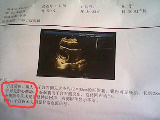 拿到B超单可以通过下面这几点查看胎儿性别