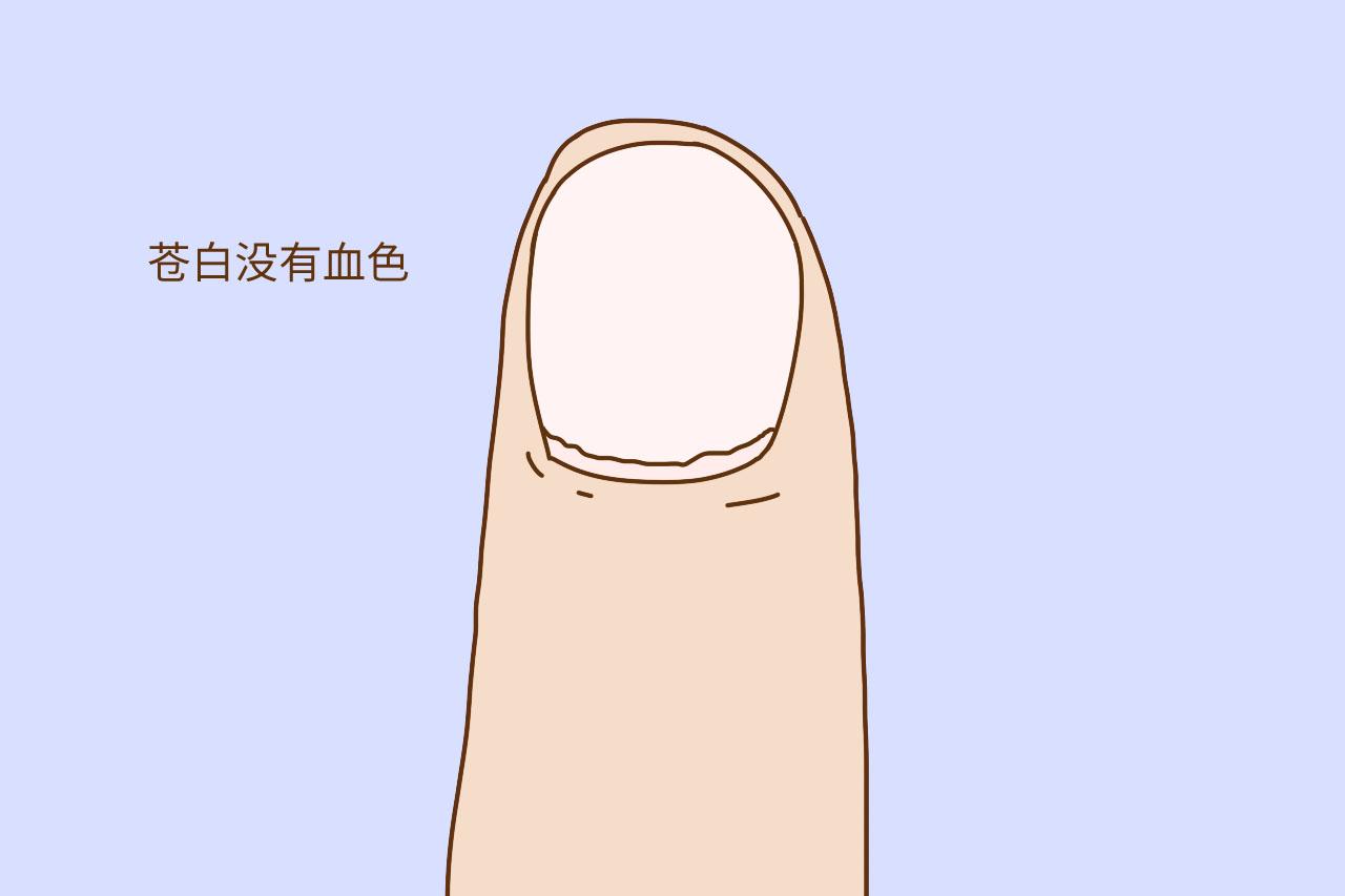 孕期贫血缺钙不自知? 准妈妈学会一招, 看懂自己“身体阴晴表”