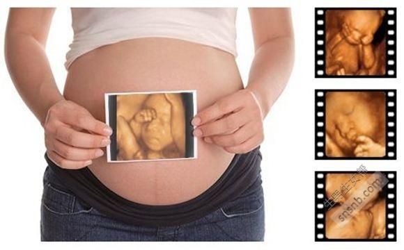 四维彩超主要检查什么, 孕妈妈们了解过吗?